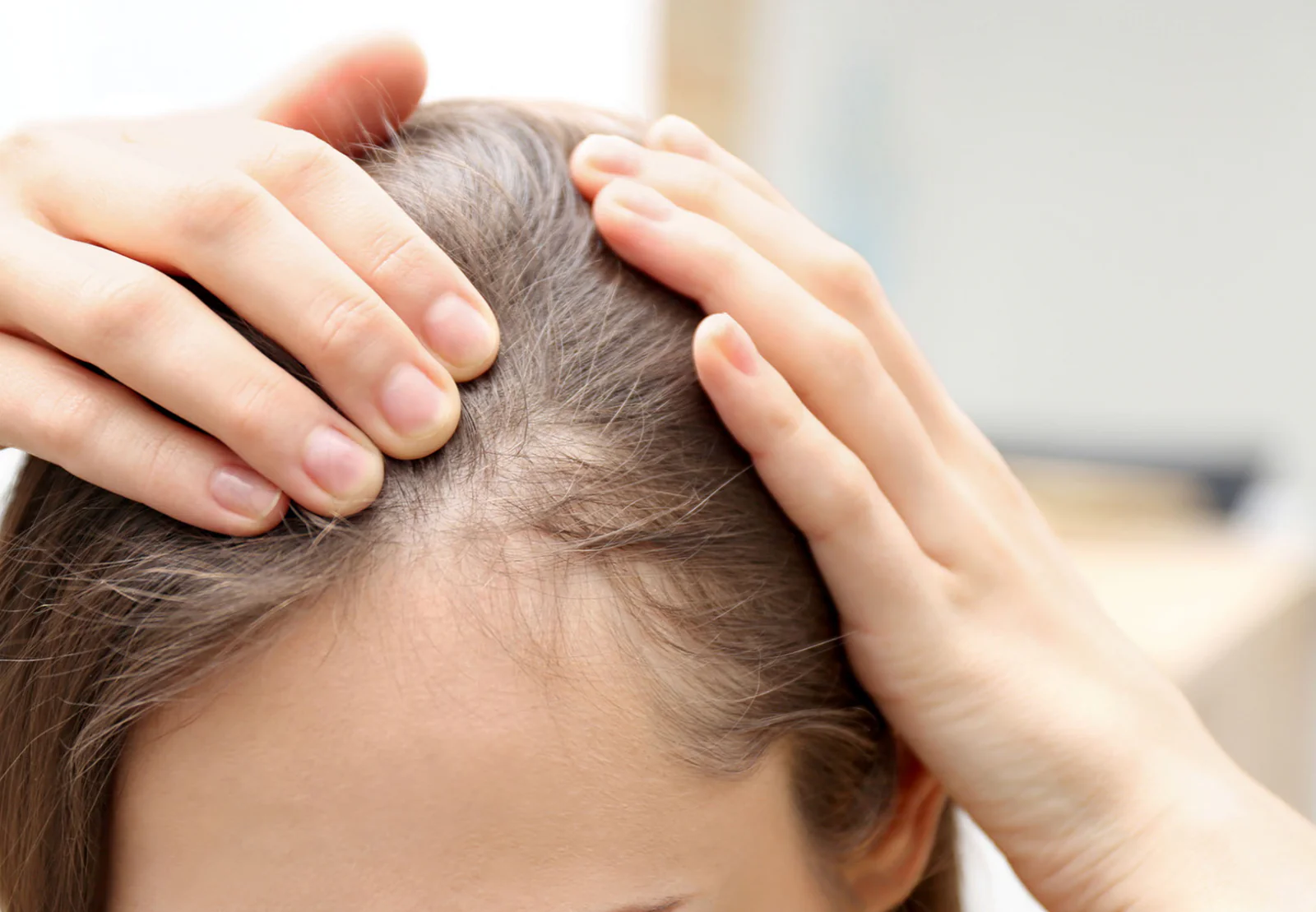 Thinning Hair